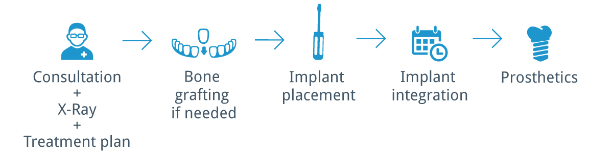 Consultation + Xray + Treatment plan; Bone grafting if needed; Implant placement; Implant integration; Prosthetics