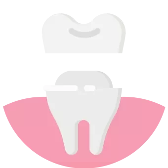 animated dental crown structure