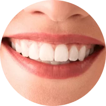 woman smiling after teeth whitening
