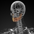 bone regeneration, implants & treatment