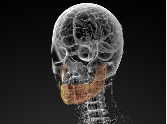 bone regeneration, implants & treatment