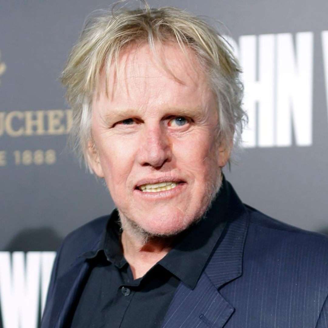 Gary Busey Dental Implants