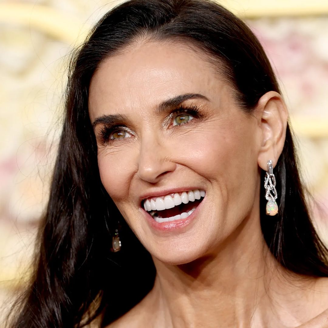 Demi Moore Dental Implants