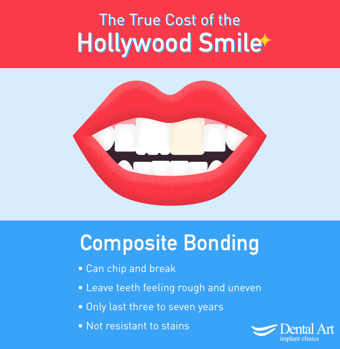 Composite Bonding Poster. Can chip and break; Leave the teeth feeling rough and uneven; Only last three to seven years; Not resistant to stains.