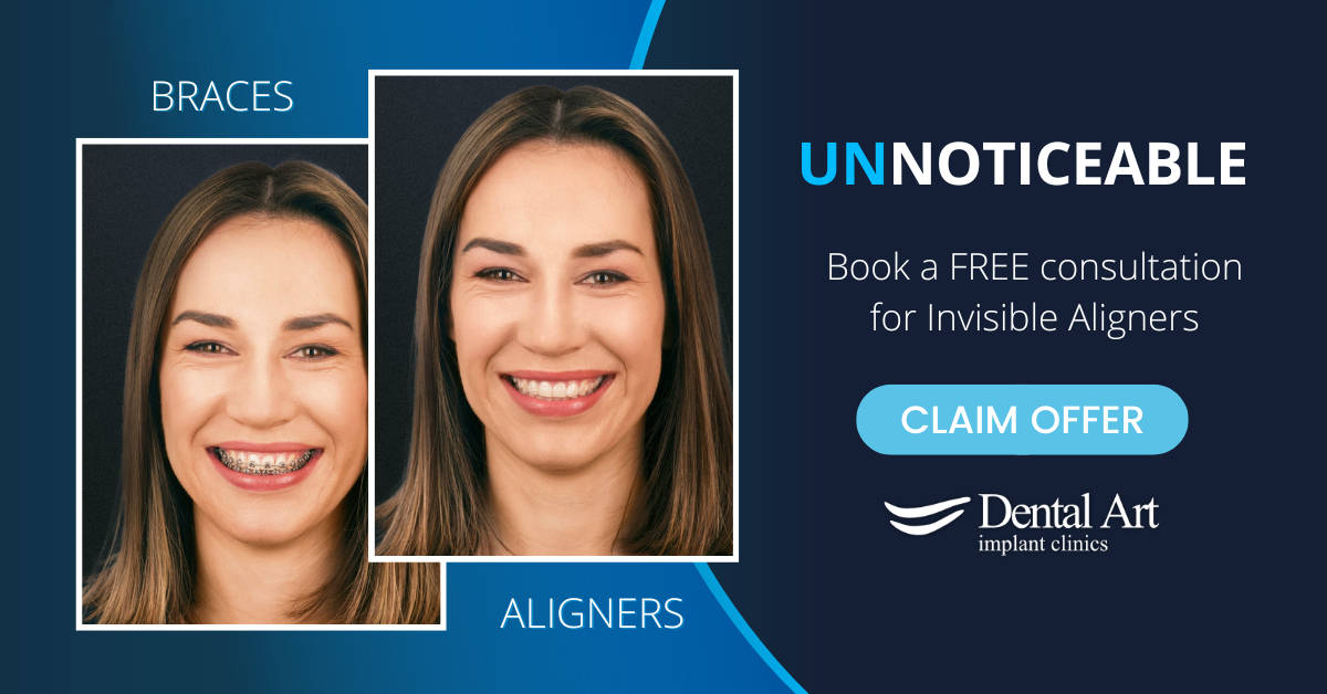 clear aligners free consultation offer banner