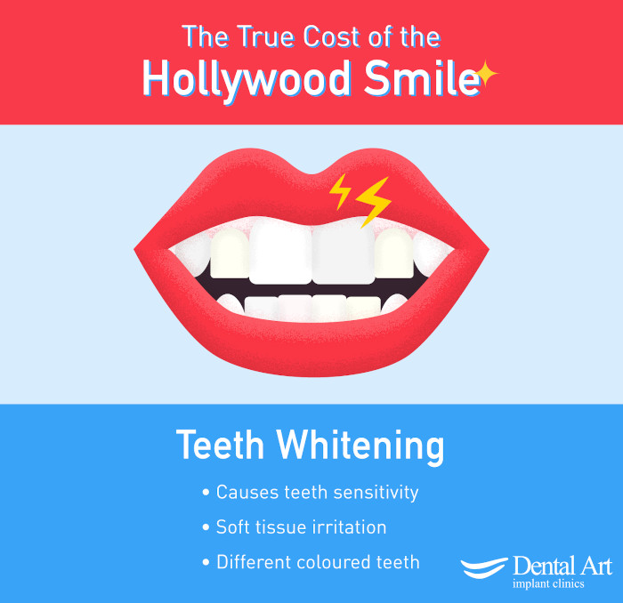 Teeth Whitening Poster. Text - Causes teeth sensitivity; Soft tissue irritation; Different coloured teeth