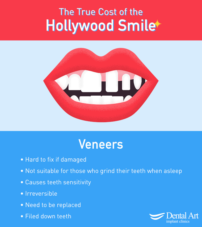 Veneer poster. Hard to fix if damaged; Not suitable for those who grind their teeth while asleep; Causes teeth sensitivity; Irreversible; Need to be replaced; Filed down teeth