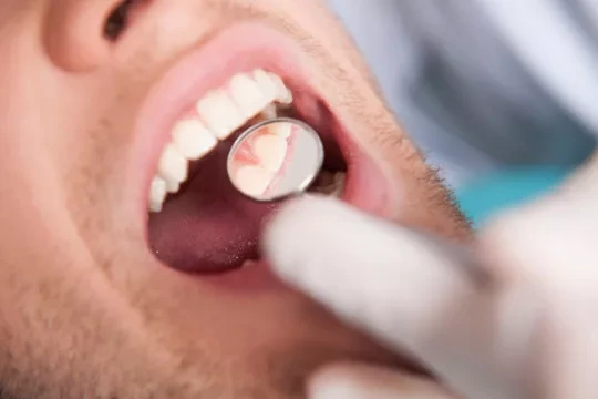 Dentist examining patient's teeth