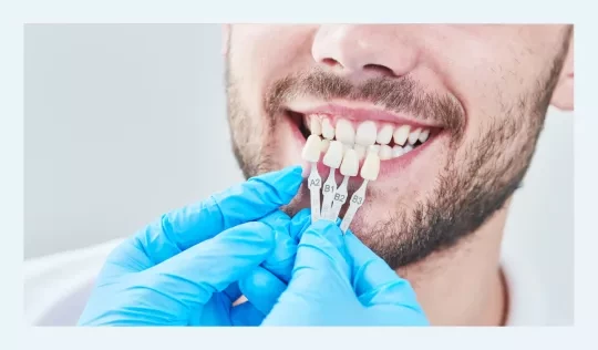Dentist holding samples of dental veneers in front of a smiling person. 