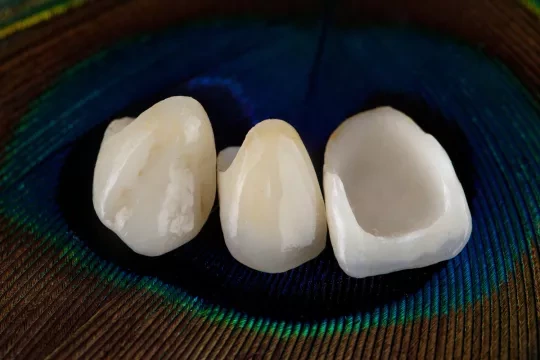 dental crowns